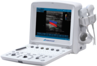 Ultrasound System DUS 5000